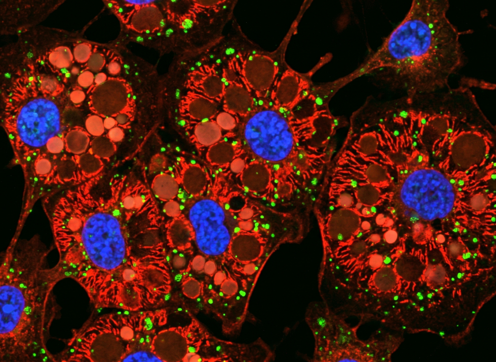 Clinical and Translational Research - Adipocytes